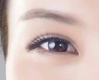 Close-up of a woman's eye and brow for Ultherapy skin lifting in Amsterdam